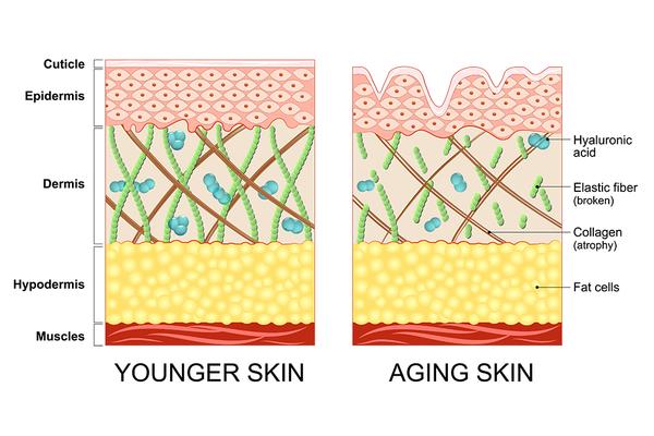aging skin ilustration