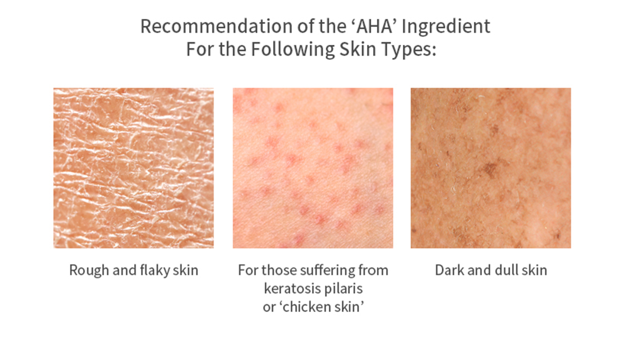 recommendation of the AHA ingredient for the following skin types