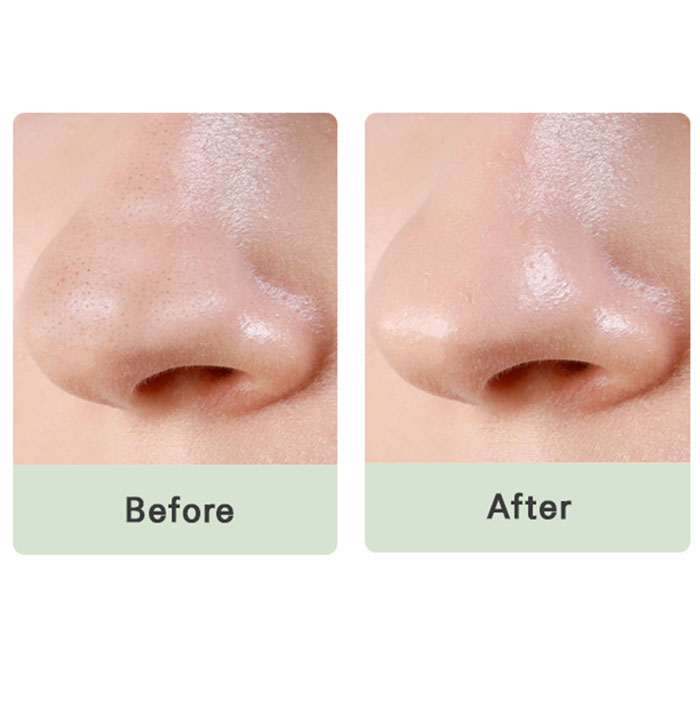 Sonar Mizon Pore Fresh Clear Nose Pack befor after - Sonar | Korean Skincare